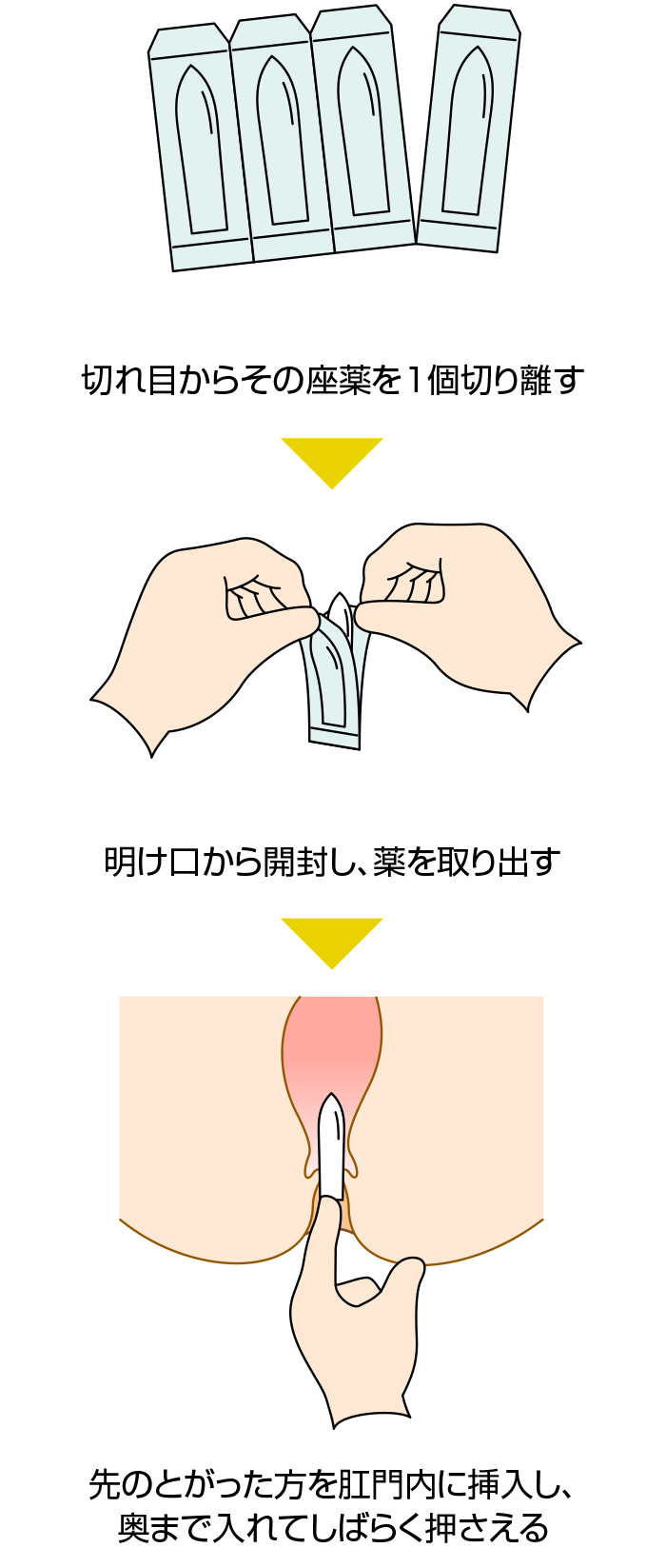 切れ 痔 座薬